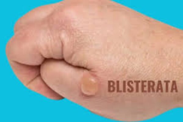 blisterata