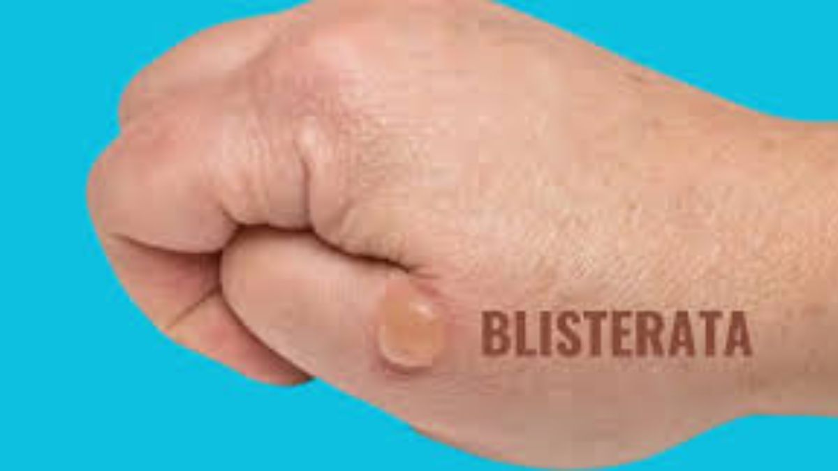 blisterata